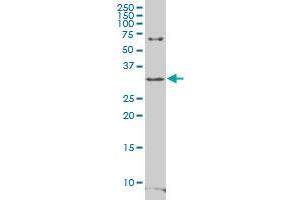 RFPL4B polyclonal antibody (A01), Lot # 060703JCS1. (RFPL4B anticorps  (AA 127-226))
