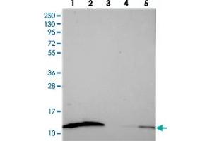 Western blot analysis of Lane 1: RT-4, Lane 2: U-251 MG, Lane 3: Human Plasma, Lane 4: Liver, Lane 5: Tonsil with S100A16 polyclonal antibody  at 1:250-1:500 dilution. (S100A16 anticorps)
