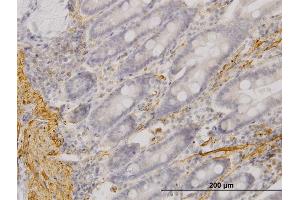 Immunoperoxidase of monoclonal antibody to MYOC on formalin-fixed paraffin-embedded human small Intestine.