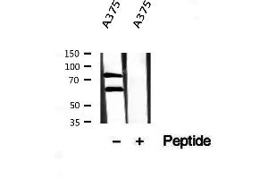 Western blot analysis of extracts from A375, using Melanophilin antibody. (Melanophilin anticorps  (C-Term))