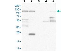 Western blot analysis of Lane 1: RT-4, Lane 2: U-251 MG, Lane 3: Human Plasma, Lane 4: Liver, Lane 5: Tonsil with WDR47 polyclonal antibody .