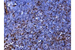 IHC-P Image Vimentin antibody detects Vimentin protein at cytosol on mouse thymus gland by immunohistochemical analysis. (Vimentin anticorps)