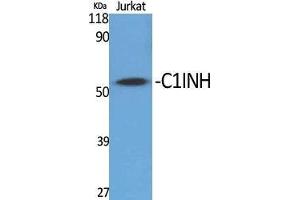 Western Blot (WB) analysis of specific cells using C1INH Polyclonal Antibody. (SERPING1 anticorps  (Internal Region))