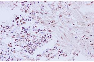 Immunohistochemistry of paraffin-embedded Human muscularis mucosa of the colon tissue using CCNL2 Polyclonal Antibody at dilution of 1:200 (Cyclin L2 anticorps)