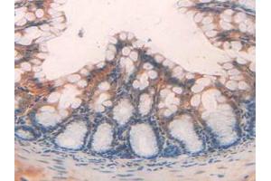 IHC-P analysis of Mouse Large Intestine Tissue, with DAB staining.