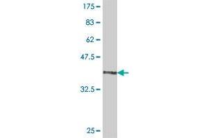 Western Blot detection against Immunogen (37 KDa) . (VPS9D1 anticorps  (AA 157-255))