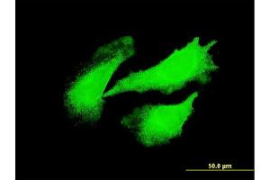 Immunofluorescence of monoclonal antibody to DYX1C1 on HeLa cell.