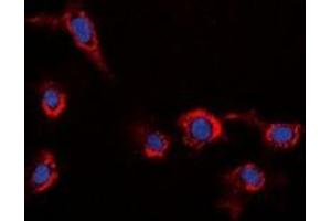Immunofluorescent analysis of HER2 staining in HeLa cells. (ErbB2/Her2 anticorps)