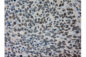 Immunohistochemical staining of paraffin-embedded Ovary tissue using anti-TMEM100mouse monoclonal antibody. (TMEM100 anticorps)