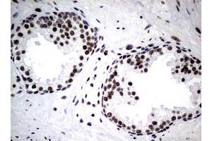 Image no. 4 for anti-Nibrin (NBN) (AA 183-460) antibody (ABIN1491066)