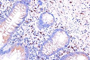 Immunohistochemistry of paraffin-embedded human appendix using C5 Rabbit pAb (ABIN6127535, ABIN6137777, ABIN6137778 and ABIN6219037) at dilution of 1:100 (40x lens). (C5AR1 anticorps  (AA 250-350))
