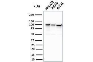 Western Blot Analysis of human HepG2, A549, and A431 cell lysate using MSH2 Mouse Monoclonal Antibody (MSH2/2622). (MSH2 anticorps  (AA 327-427))
