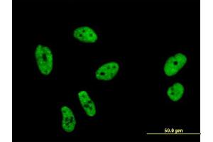 Immunofluorescence of monoclonal antibody to SF1 on HeLa cell.