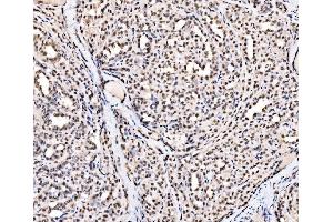 IHC analysis of SSB using anti-SSB antibody (ABIN7602125). (SSB anticorps  (AA 6-283))