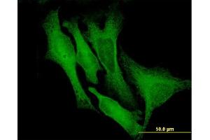 Immunofluorescence of monoclonal antibody to DCX on HeLa cell.