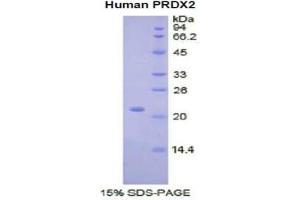 SDS-PAGE of Protein Standard from the Kit  (Highly purified E.