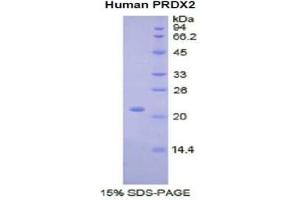 SDS-PAGE of Protein Standard from the Kit  (Highly purified E. (Peroxiredoxin 2 Kit ELISA)