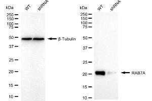 Western blotting analysis using RAB7A antibody (ABIN7800103).