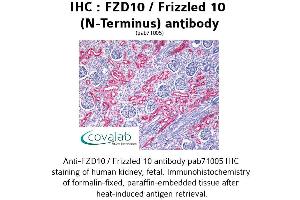 Image no. 1 for anti-Frizzled Family Receptor 10 (FZD10) (Extracellular Domain), (N-Term) antibody (ABIN1734497) (FZD10 anticorps  (Extracellular Domain, N-Term))