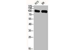 Western Blot analysis of PC3 KB cells using GRIN1 Polyclonal Antibody (GPRIN1 anticorps  (Internal Region))