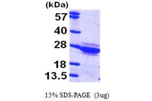 SDS-PAGE (SDS) image for Cytoglobin (CYGB) (AA 1-190) protein (His tag) (ABIN7279055)