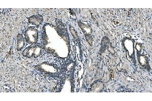 IHC analysis of Carbonic Anhydrase I/CA1 using anti-Carbonic Anhydrase I/CA1 antibody (ABIN7602621). (CA1 anticorps  (AA 9-261))
