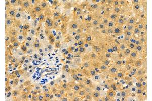 ABIN6265484 and ABIN6276350 at 1/100 staining Rat liver tissue by IHC-P. (TBRG4 anticorps  (C-Term))