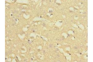 Immunohistochemistry of paraffin-embedded human brain tissue using ABIN7161622 at dilution of 1:100