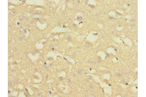 Immunohistochemistry of paraffin-embedded human brain tissue using ABIN7161622 at dilution of 1:100 (Nischarin anticorps  (AA 500-700))