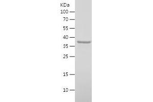 Western Blotting (WB) image for Leucine-rich repeat protein SHOC-2 (SHOC2) (AA 1-96) protein (His-IF2DI Tag) (ABIN7123754)