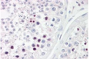 Anti-RFX3 antibody IHC staining of human testis.