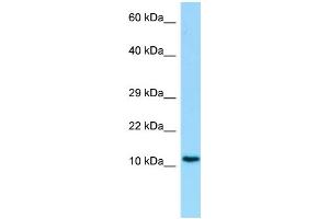 Host: Rabbit Target Name: C19orf10 Antibody Dilution: 1. (C19orf10 anticorps  (Middle Region))
