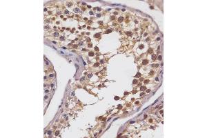 (ABIN6242872 and ABIN6578693) staining SLC2A8 in human testis tissue sections by Immunohistochemistry (IHC-P - paraformaldehyde-fixed, paraffin-embedded sections). (SLC2A8 anticorps  (AA 260-292))