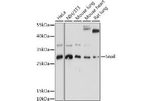 Western blot analysis of extracts of various cell lines, using Snail antibody (ABIN6134928, ABIN6148176, ABIN6148179 and ABIN6215911) at 1:1000 dilution. (SNAIL anticorps  (C-Term))