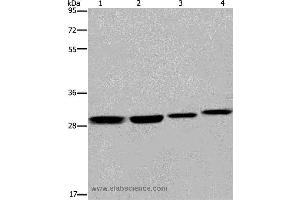 Western blot analysis of 293T and LoVo cell, mouse skin tissue and A172 cell, using ETV7 Polyclonal Antibody at dilution of 1:600 (ETV7 anticorps)
