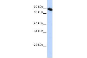 WB Suggested Anti-ZNF780A Antibody Titration:  0. (ZNF780A anticorps  (N-Term))