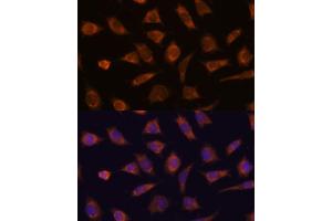 Immunofluorescence analysis of L929 cells using C antibody (ABIN7266029) at dilution of 1:100. (CAMSAP1 anticorps  (AA 350-650))