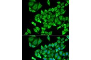 Immunofluorescence analysis of U2OS cells using DHRS9 Polyclonal Antibody (DHRS9 anticorps)