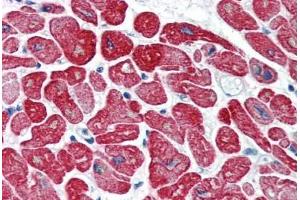 Human Heart (formalin-fixed, paraffin-embedded) stained with TPM1 antibody ABIN337101 at 5 ug/ml followed by biotinylated anti-mouse IgG secondary antibody ABIN481714, alkaline phosphatase-streptavidin and chromogen. (Tropomyosin anticorps)