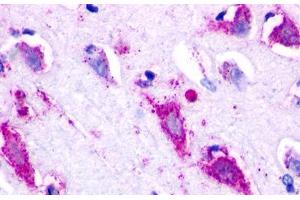 Image no. 1 for anti-G Protein-Coupled Receptor 22 (GPR22) (N-Term) antibody (ABIN1048779)