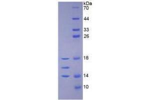 Image no. 1 for Interleukin 15 (IL15) (AA 50-162) (Active) protein (His tag) (ABIN6239761)