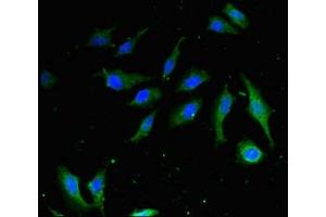 Immunofluorescent analysis of Hela cells using ABIN7155201 at dilution of 1:100 and Alexa Fluor 488-congugated AffiniPure Goat Anti-Rabbit IgG(H+L)