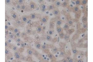 Detection of RAGE in Rat Liver Tissue using Polyclonal Antibody to Receptor For Advanced Glycation Endproducts (RAGE)