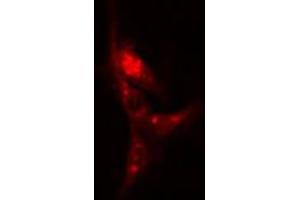 ABIN6266570 staining A-431 cells by IF/ICC. (KRT17 anticorps  (C-Term))