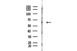 Western blot analysis of lysates from Hela cells(heat-shock, 45 min treatment), using IGF2BP2 Antibody at 1/1000 dilution.