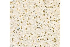 Immunohistochemistry of paraffin embedded mouse brain using Kcnh5 (ABIN7075159) at dilution of 1:100 (400x lens) (KCNH5 anticorps)