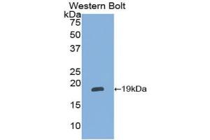 Western blot analysis of the recombinant protein. (alpha 2 Antiplasmin anticorps  (AA 348-491))