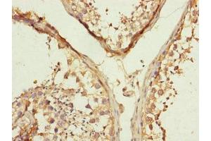 Immunohistochemistry of paraffin-embedded human testis tissue using ABIN7159967 at dilution of 1:100 (MFN1 anticorps  (AA 622-741))