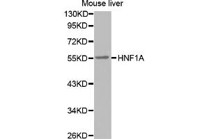 Western blot analysis of extracts of mouse liver, using HNF1A antibody (ABIN5971580). (HNF1A anticorps)
