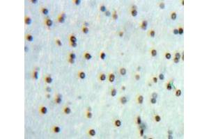 Used in DAB staining on fromalin fixed paraffin-embedded Brain tissue (CAN anticorps  (AA 7-301))